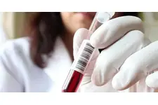 Folik Asit Testi Nedir ve Nasıl Yapılır?