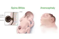 Gebelikte Folik Asit Eksikliği Belirtileri ve Tedavisi