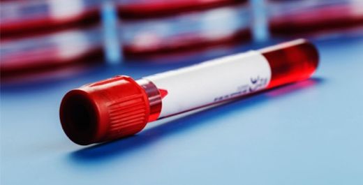 Folik Asit Fazlalığı Nedir?